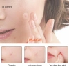 LUImo Miếng Dán Tròn Trong Suốt 36/180 Cái Chăm sóc da giảm mụn dụng cụ trang điểm SBS giá tốt 2