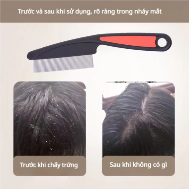 Lược thép không gỉ loại bỏ chấy rận - Dụng cụ hiệu quả, giá chỉ 43.888 VND
