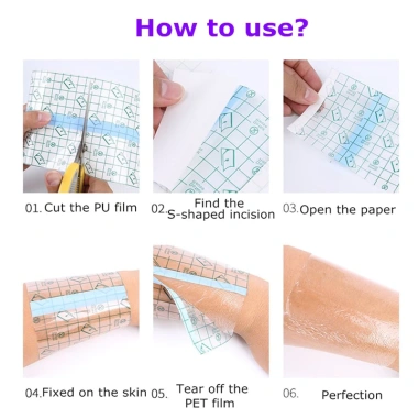 MANCHER băng dính y tế chống thấm nước - Dán vết thương, bảo vệ hiệu quả, dễ dùng 4