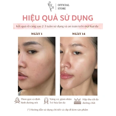 Massage Gua Sha Thép Không Gỉ Cao Cấp - Nâng Cơ, Trẻ Hoá Da Mặt Giá Ưu Đãi 285.000 VNĐ