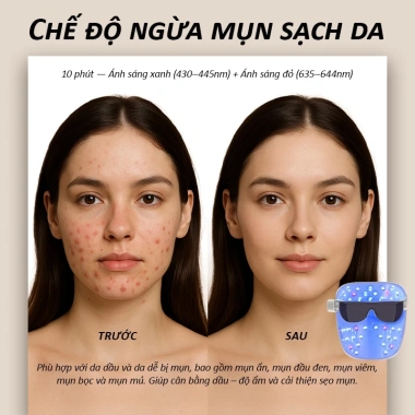 Mặt Nạ Ánh Sáng Sinh Học NIPLIFE EM-01 - Trẻ Hóa Làn Da, Công Nghệ Sinh Học, Giá 4.799.999 VNĐ 2