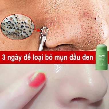 Mặt Nạ Bùn Trà Xanh 40g Dưỡng Ẩm Kiềm Xóa Mụn Đầu Đen, Se Khít Lỗ Chân Lông, Sáng Da