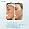 Mặt nạ cấp ẩm Glass Skin Skin Lab Aquaring – Da căng bóng, dưỡng ẩm sâu 1 miếng 84.460₫ 7