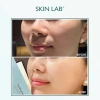 Mặt nạ cấp ẩm Glass Skin Skin Lab Aquaring – Da căng bóng, dưỡng ẩm sâu 1 miếng 84.460₫ 8