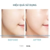 Mặt Nạ Cicasoo Lẻ Miếng Siêu Phục Hồi Dưỡng ẩm sâu, Tăng đề kháng - Giá 113.059 VND 8