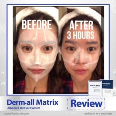 Mặt Nạ Derm All Matrix Mẫu Mới Nhất 4 Miếng Dưỡng Da Giảm Nếp Nhăn Chỉ 340.000đ 4