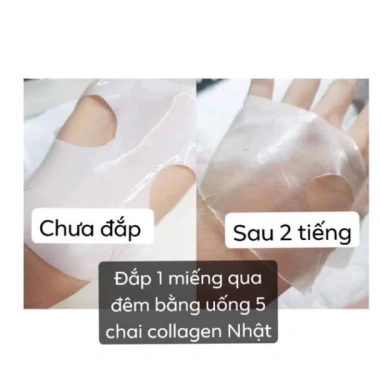 Mặt Nạ Derm All Matrix Mẫu Mới Nhất 4 Miếng Dưỡng Da Giảm Nếp Nhăn Chỉ 340.000đ 6