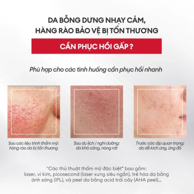 Mặt Nạ Đông Khô Collagen Winona Phục Hồi Làm Dịu Da Nhạy Cảm Giá Ưu Đãi 259k 3