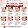 Mặt Nạ Giấy CNXUER Vitamin B5 Đỏ 25ml - Dưỡng ẩm sâu, 10 tặng 2 miếng, Giá 95.000₫ 2