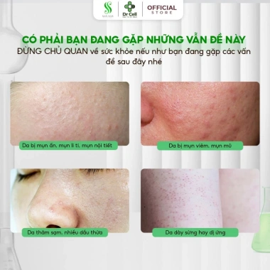 Mặt nạ hạt ngũ hoa nguyên chất SAN21 100g - Cấp ẩm, làm sáng da, chống lão hóa, giá ưu đãi 150.000 VND