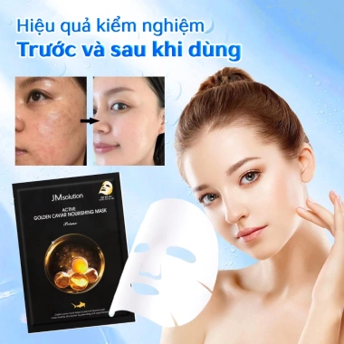 Mặt nạ JMsolution trứng cá Hàn Quốc 10 miếng - Dưỡng ẩm, sáng, chống lão, da mọi - 219.000₫
