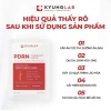 Mặt Nạ Kyunglab PDRN Therapy: Cấp ẩm, phục hồi, căng bóng, trẻ hoá chỉ 20.000₫ 3