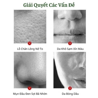Mặt Nạ Lăn Trà Xanh – Da Trắng Mịn, Se Khít Lỗ Chân Lông, Loại Bỏ Mụn Đầu Đen, Giá 55.000 VND