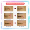 Mặt Nạ Nâng Cơ Xóa Nhăn CareCella – Cấp Ẩm, Mờ Thâm, Dưỡng Da, Da Mềm Mịn 7