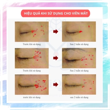 Mặt Nạ Nâng Cơ Xóa Nhăn CareCella – Cấp Ẩm, Mờ Thâm, Dưỡng Da, Da Mềm Mịn 7