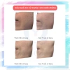 Mặt Nạ Nâng Cơ Xóa Nhăn CareCella – Cấp Ẩm, Mờ Thâm, Dưỡng Da, Da Mềm Mịn 8