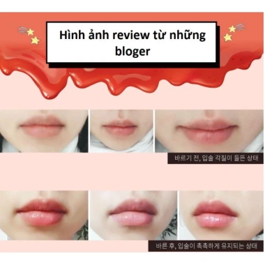 Mặt Nạ Ngủ Dưỡng Ẩm Môi Căng Mọng Hồng Hào Hàn Quốc Care:nel Berry – Giá chỉ 57.000₫ 5 Mặt Nạ Ngủ Dưỡng Ẩm Môi Căng Mọng Hồng Hào Hàn Quốc Care:nel Berry – Giá chỉ 57.000₫ 5