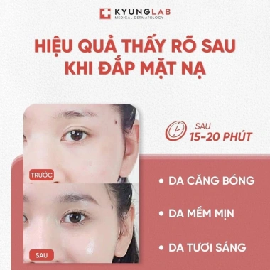 Mặt Nạ PDRN Kyunglab 23ml Cấp ẩm Chuyên sâu - Giảm giá 119k Cây Rơm Cosmetics