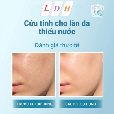 Mặt nạ SHINCOS.LAB Hyaluronic Acid 27ml - Dưỡng ẩm sâu, Da mềm mịn, 70.200₫
