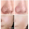Mặt nạ sủi bọt bơ 10 gói - Làm sạch sâu, giảm mụn đầu đen, thu nhỏ lỗ chân lông, dưỡng ẩm, cấp nước, chỉ 24.999đ 3