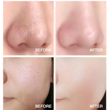 Mặt nạ sủi bọt bơ 10 gói - Làm sạch sâu, giảm mụn đầu đen, thu nhỏ lỗ chân lông, dưỡng ẩm, cấp nước, chỉ 24.999đ 3
