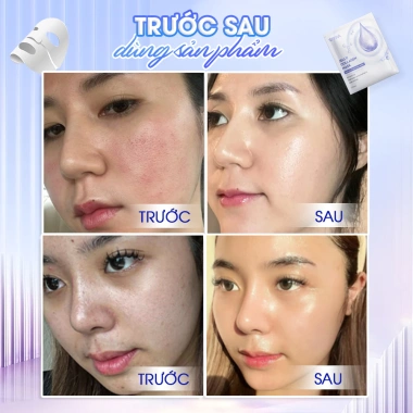 Mặt Nạ Thạch Collagen SEYOUL Căng Bóng Da Cấp Ẩm Mịn Màng Combo 3 Hộp 997k