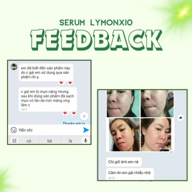 Mặt nạ ủ trắng Yến Collagen Lymon 10 hộp - Giảm 20% - Da sáng mịn, tái collagen