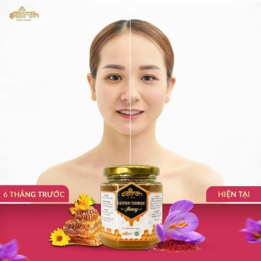 Mật ong saffron tinh bột nghệ 180ml giảm 390k, kèm ly cây lấy mật, hỗ trợ sức khỏe 3