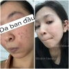 Mẫu mới Hồng Sâm Tái Tạo Mcskin nâng cấp chính hãng - Giá 143.998 VND 5