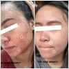 Mẫu mới Hồng Sâm Tái Tạo Mcskin nâng cấp chính hãng - Giá 143.998 VND 7