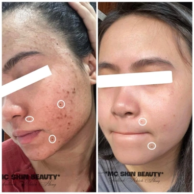 Mẫu mới Hồng Sâm Tái Tạo Mcskin nâng cấp chính hãng - Giá 143.998 VND 7 Mẫu mới Hồng Sâm Tái Tạo Mcskin nâng cấp chính hãng - Giá 143.998 VND 7