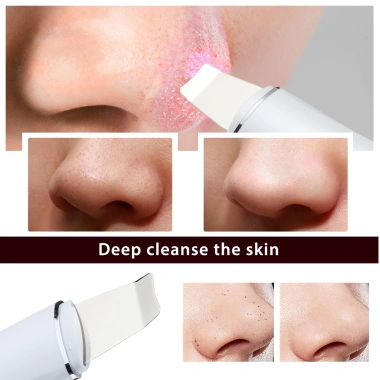 Máy chà sàn da siêu âm Rung - Loại bỏ lỗ chân lông, Xẻng mặt, Đầu trắng, Cavitation Peeling chỉ 265.449₫