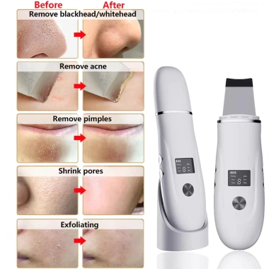 Máy chà sàn siêu âm da mặt - Làm sạch sâu, thu nhỏ lỗ chân lông, thẻ mụn, kèm sữa rửa mặt - Giá ưu đãi 269.426₫