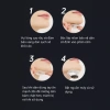 Máy Chống Ngáy Snore Circle – Xung TENS, Dán Cằm, Cấp Độ Rung, Ngủ Sâu, Giá 750.000 VND 8