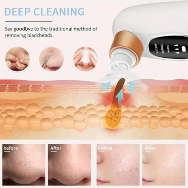 Máy hút chân không lỗ chân lông MKEB - Loại bỏ mụn đầu đen di động, tái chế, làm sạch da mặt hiệu quả