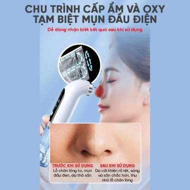 Máy hút mụn 6 đầu cầm tay pin sạc, loại bỏ mụn đầu đen, cám, bã nhờn - 249.000đ 5