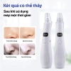 Máy hút mụn đầu đen GOKE 5 đầu, làm sạch lỗ chân lông, bảo hành 1 năm - 176.000₫ 3