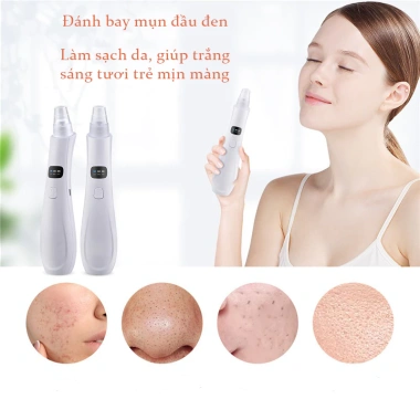 Máy hút mụn đầu đen GOKE 5 đầu, làm sạch lỗ chân lông, bảo hành 1 năm - 176.000₫ 4