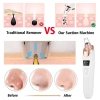 Máy hút mụn đầu đen làm sạch sâu, thu nhỏ lỗ chân lông - Giá chỉ 418.000 VNĐ 3