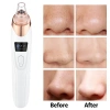 Máy hút mụn đầu đen làm sạch sâu, thu nhỏ lỗ chân lông - Giá chỉ 418.000 VNĐ 6