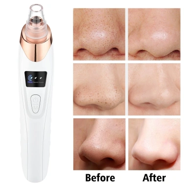 Máy hút mụn đầu đen làm sạch sâu, thu nhỏ lỗ chân lông - Giá chỉ 418.000 VNĐ
