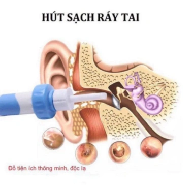 Máy Hút Ráy Tai Nhật Bản An Toàn Cho Bé - Tự Động, Giá Ưu Đãi 63.502 VND 3 Máy Hút Ráy Tai Nhật Bản An Toàn Cho Bé - Tự Động, Giá Ưu Đãi 63.502 VND 3