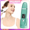 Máy Mát Xa Siêu Âm Tẩy Tế Bào Chết, Làm Sạch Sâu, Loại Bỏ Mụn Đầu Đen và Nếp Nhăn - Giá Ưu Đãi 339.570₫