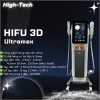 Máy Nâng Cơ HIFU Ultramatrix Cao Cấp - Siêu Âm 3D, Giảm Đôi Giá, Da Mịn Tự Nhiên 2
