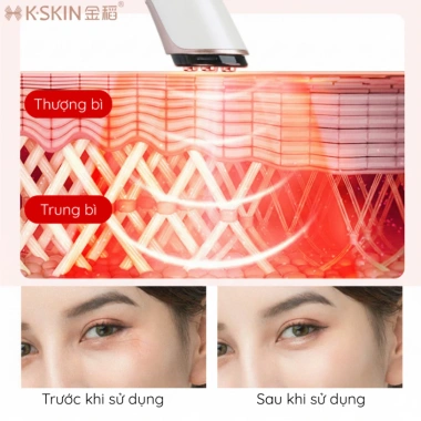 Máy nâng cơ KSKIN KD998 RF và EMS: Xoá nếp nhăn, thâm mắt, trẻ hoá da - Giá ưu đãi 608.300₫