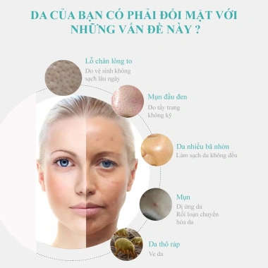 Máy rửa mặt 4 trong 1 CSSD14 - tẩy trang, tẩy da chết, massage, giá 511.000₫ 2