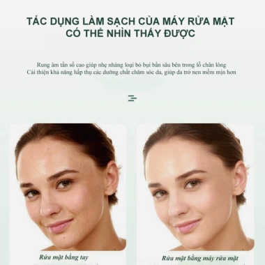 Máy rửa mặt 4 trong 1 CSSD14 - tẩy trang, tẩy da chết, massage, giá 511.000₫ 3