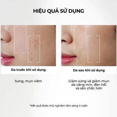 Máy Rửa Mặt Massage Ánh Sáng Nhiệt STOREEVA - Làm Sạch Sâu, Thư Giãn 629k 3