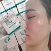 MESO X5 N.M.N siuuu Căng bóng gấp 5 lần, giảm nếp nhăn, giá ưu đãi 275k 5