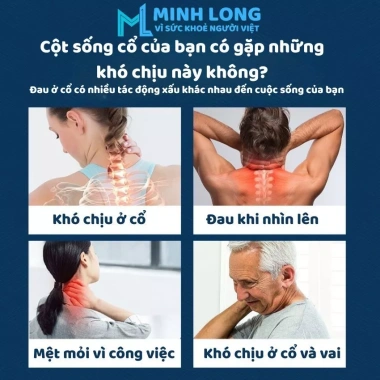 Miếng Cao Dán Giảm Đau Cổ Vai Gáy - Giảm Đau Mỏi Cơ Nhanh, Giá Ưu Đãi 53.720 VND 2